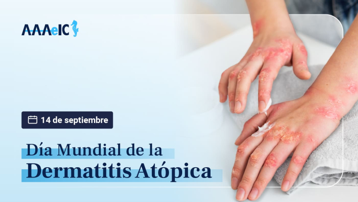 14 de septiembre: Día Mundial de la Dermatitis Atópica